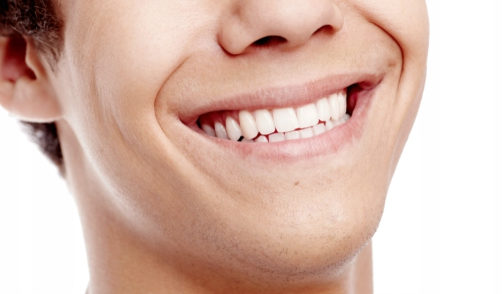 Działanie pasty Vitis Gingival na krwawiące dziąsła
