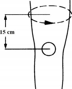 ORTHO VISIONS ORTEZA OPASKA NA KOLANO STABILIZATOR KOLANA RZEPKI 3
