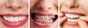 Irygator Oclean A10 Zielony 9